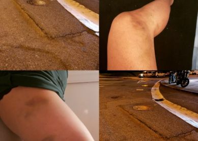 Asfalto en mal estado